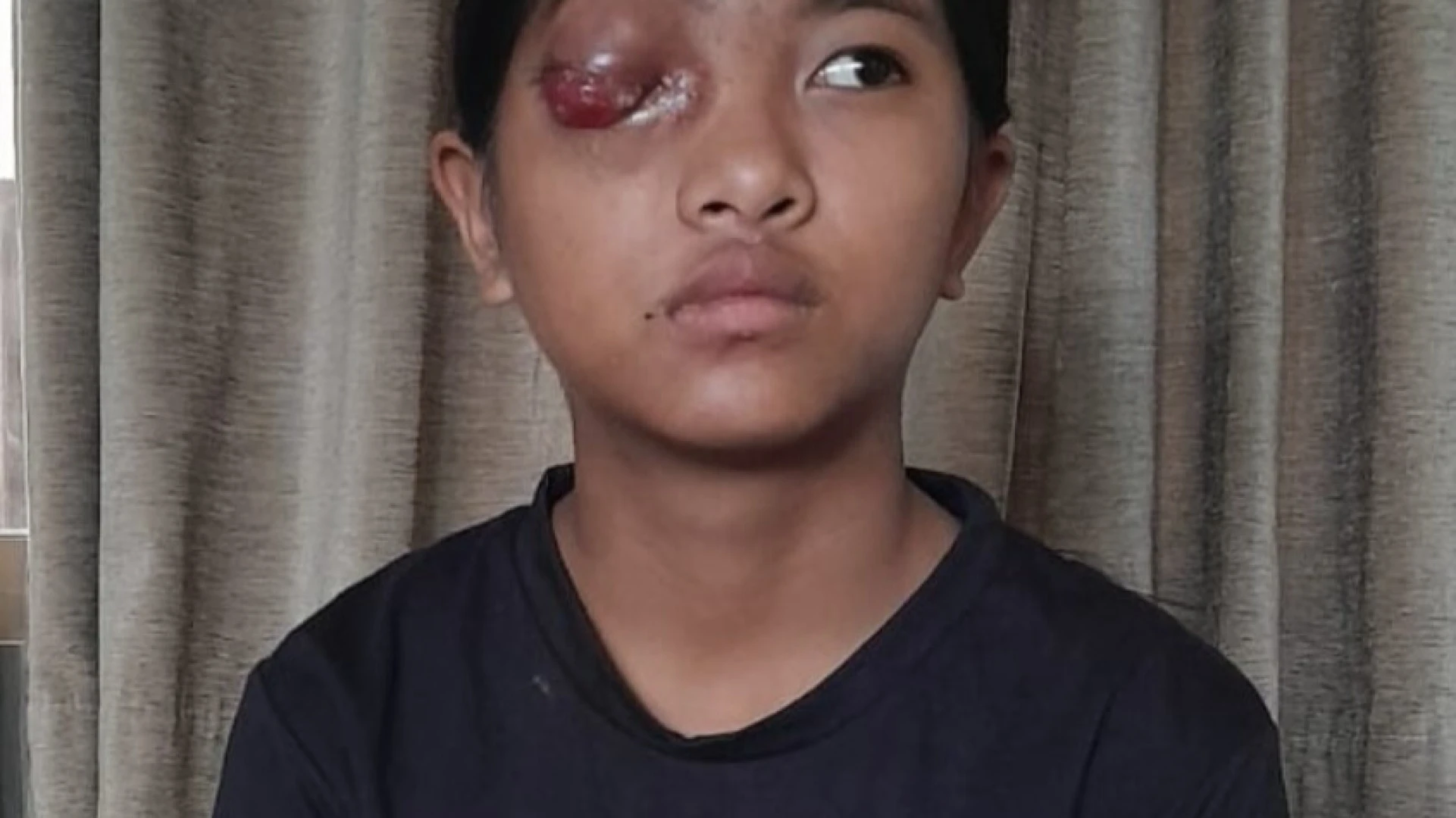 PAWL 6 ZIRLAI DINDINI MIT CANCER ENKAWL NAN VEHBUR KHAWNIN HMA KAN LO LAKSAK E